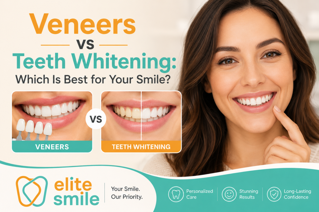 Veneers vs Teeth Whitening: Which Is Best for Your Smile?