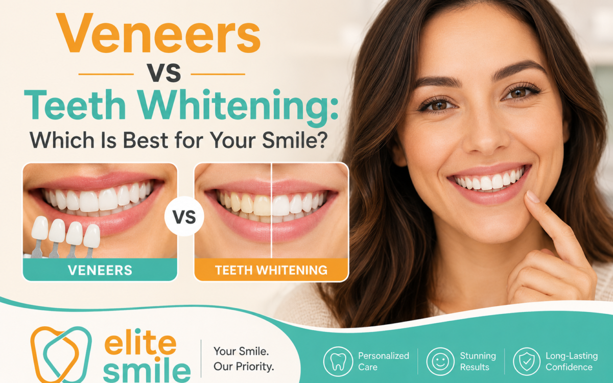 Veneers vs Teeth Whitening: Which Is Best for Your Smile?