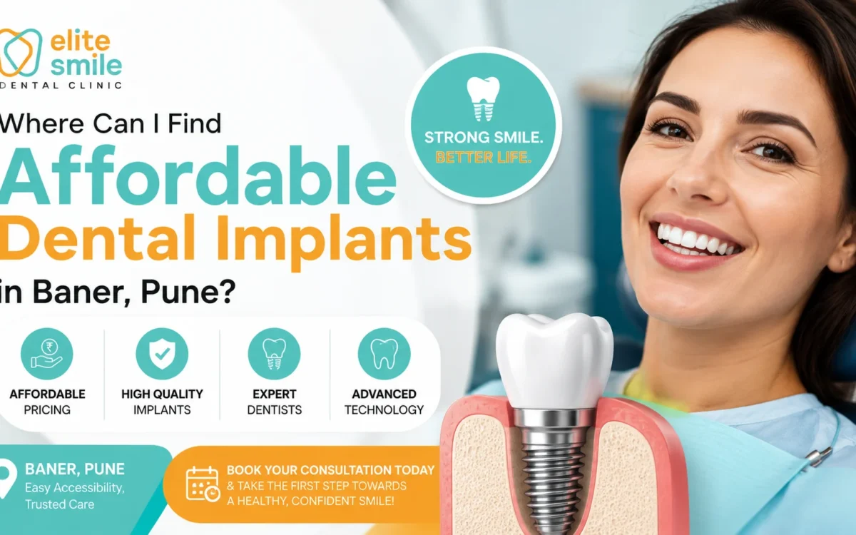 Affordable Dental Implants in Baner, Pune: Real Cost, Process & How to Choose the Right Clinic (2026 Guide)
