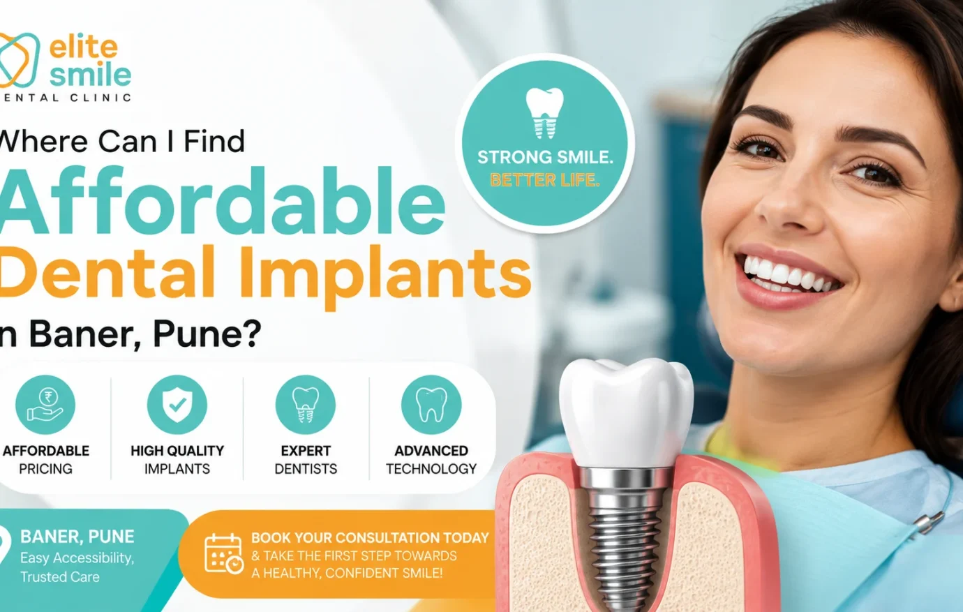 Affordable Dental Implants in Baner, Pune: Real Cost, Process & How to Choose the Right Clinic (2026 Guide)