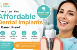 Where Can I Find Affordable Dental Implants in Baner, Pune?