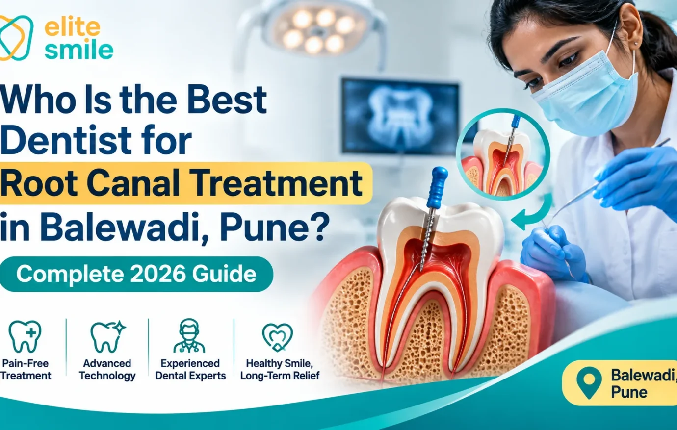 Best Dentist for Root Canal Treatment in Balewadi, Pune | 2026 Who Is the Best Dentist for Root Canal Treatment in Balewadi, Pune? Complete 2026 Guide