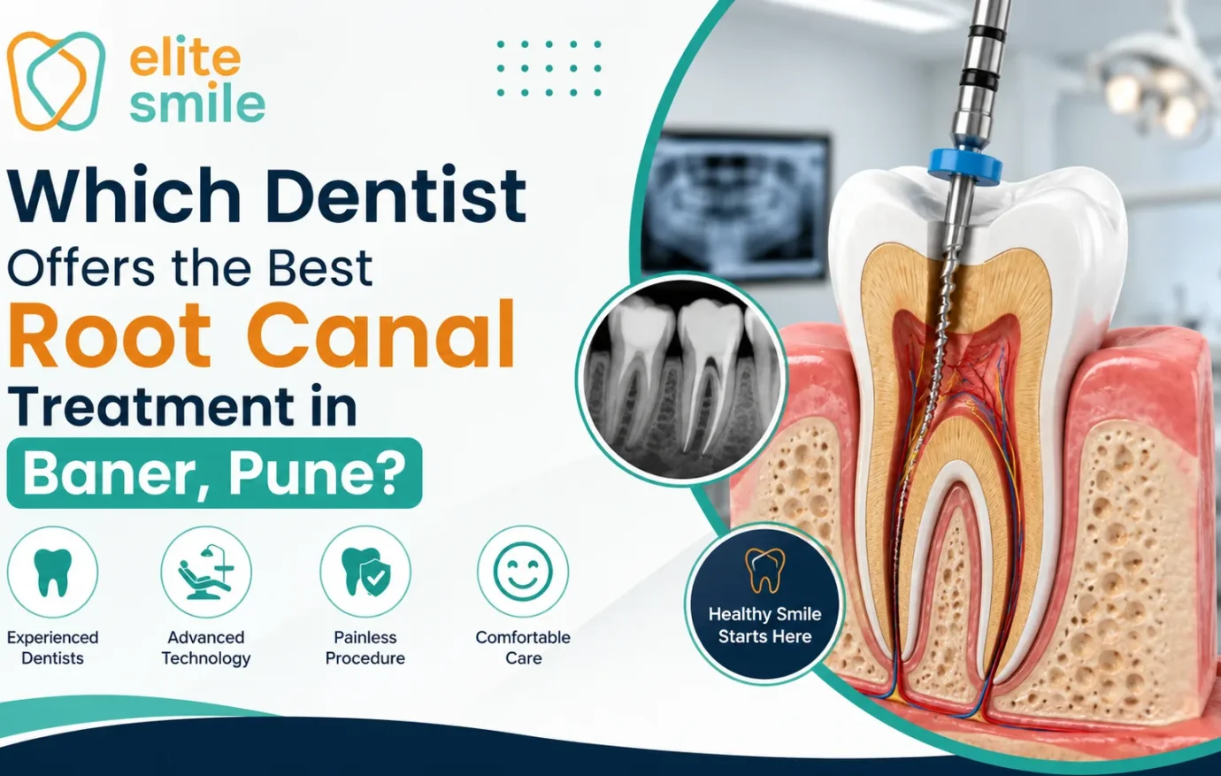 Find trusted root canal treatment in Baner, Pune with Dr. Krunali Talekar at Elite Smile Dental Clinic. Painless RCT, transparent costs, expert care.