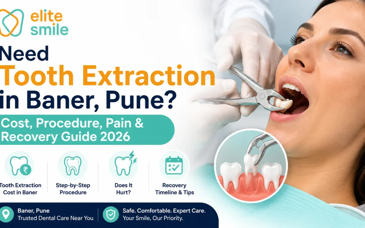 Tooth Extraction in Baner, Pune: Cost, Pain & Recovery 2026