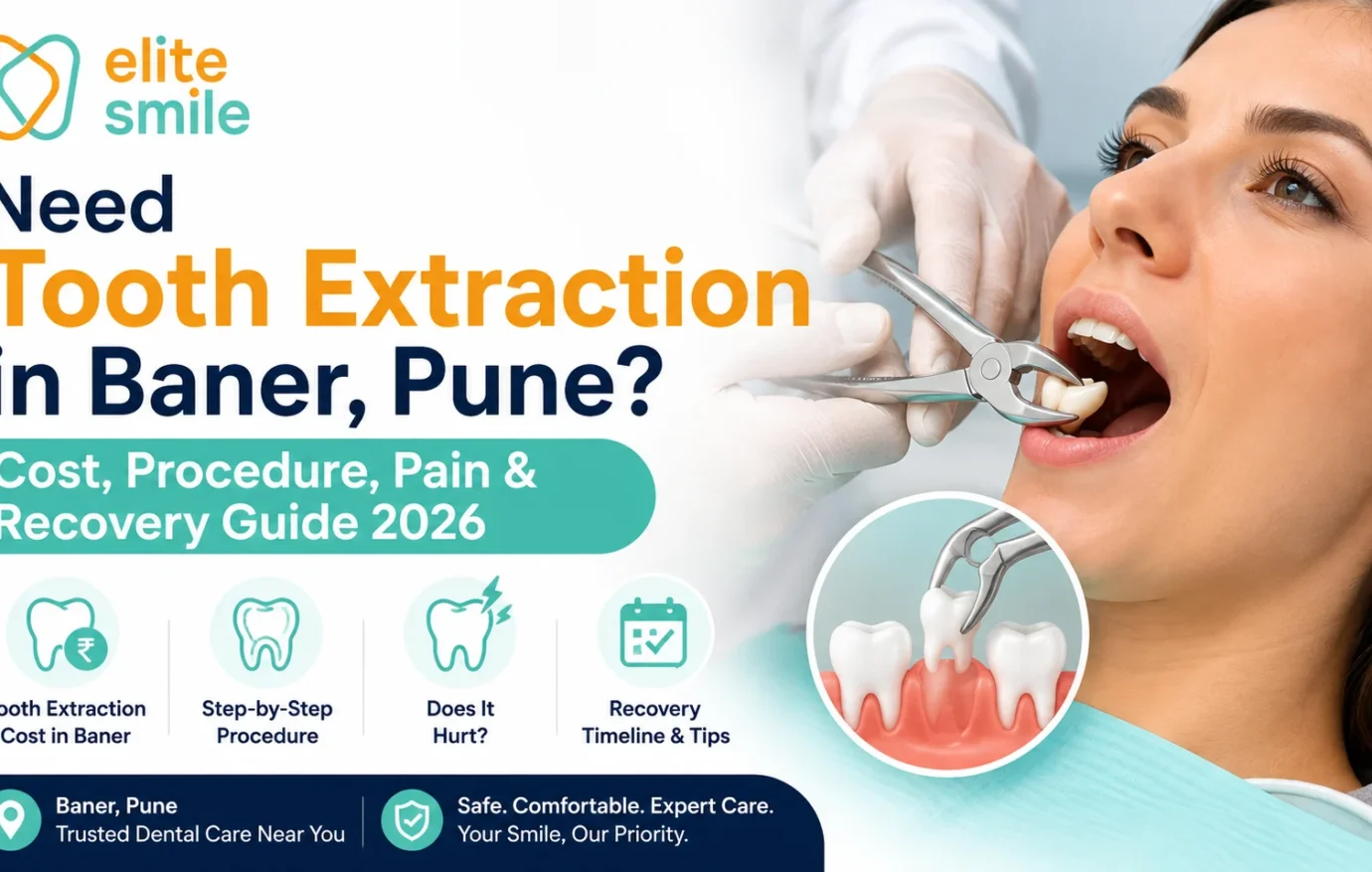 Need Tooth Extraction in Baner, Pune? Cost & Recovery 2026 Tooth Extraction in Baner, Pune: Cost, Pain & Recovery 2026