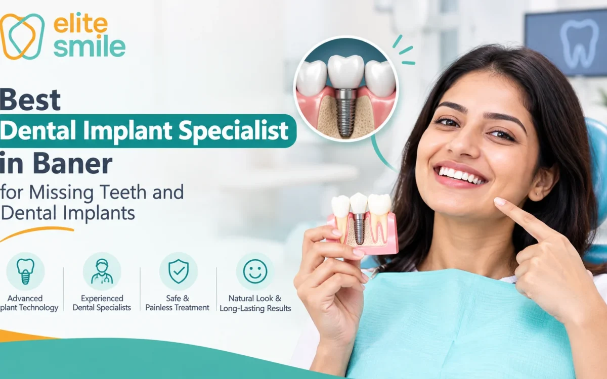 Best Dental Implant Specialist in Baner for Missing Teeth and Dental Implants