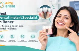 Best Dental Implant Specialist in Baner for Missing Teeth and Dental Implants