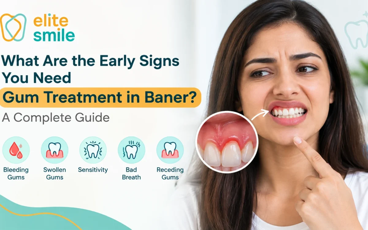 What Are the Early Signs You Need Gum Treatment in Baner? A Complete Guide