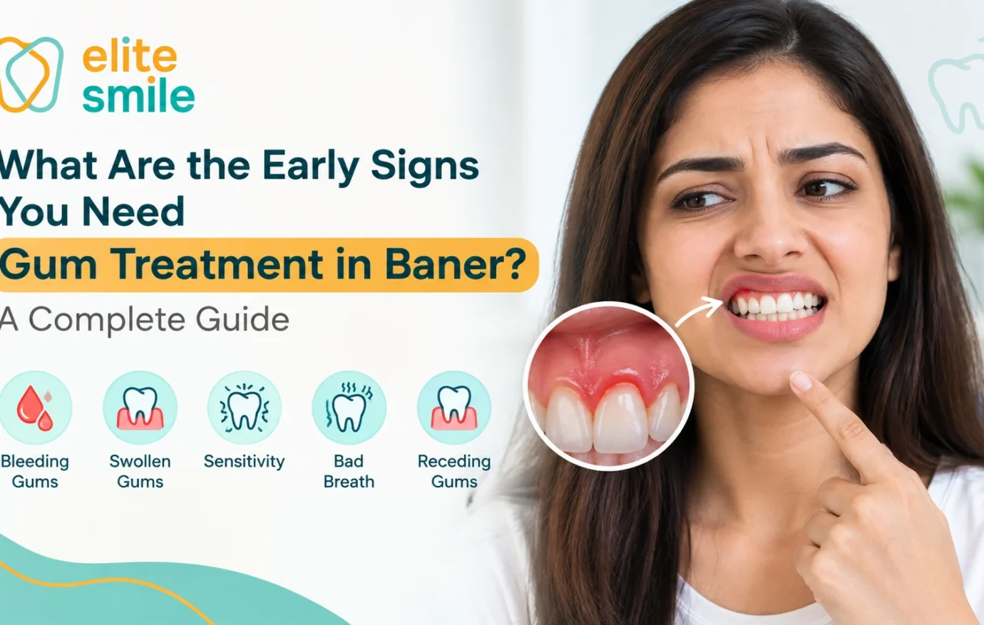 What Are the Early Signs You Need Gum Treatment in Baner? A Complete Guide