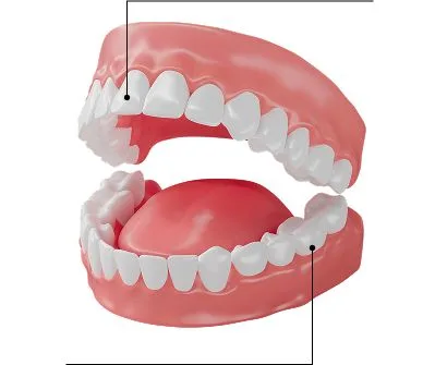 Full Mouth Rehabilitation Baner | Crowns, Implants & More