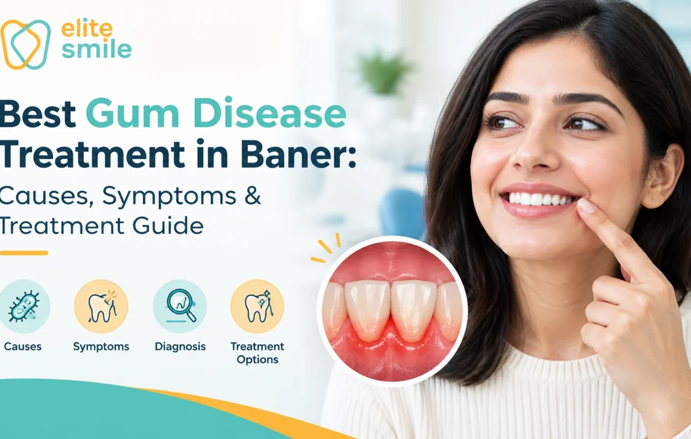Best Gum Disease Treatment in Baner: Causes, Symptoms & Treatment Guide Best Gum Disease Treatment in Baner: Causes, Symptoms & Treatment Guide