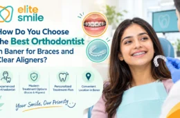 How Do You Choose the Best Orthodontist in Baner for Braces and Clear Aligners?