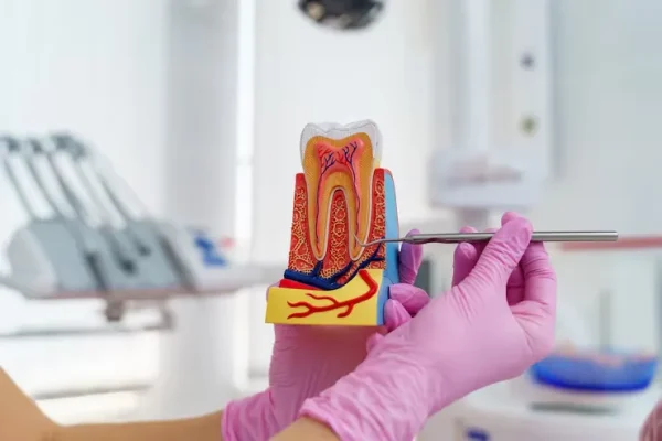 Root Canal Treatment in Baner, Pune – Cost, Procedure & Benefits