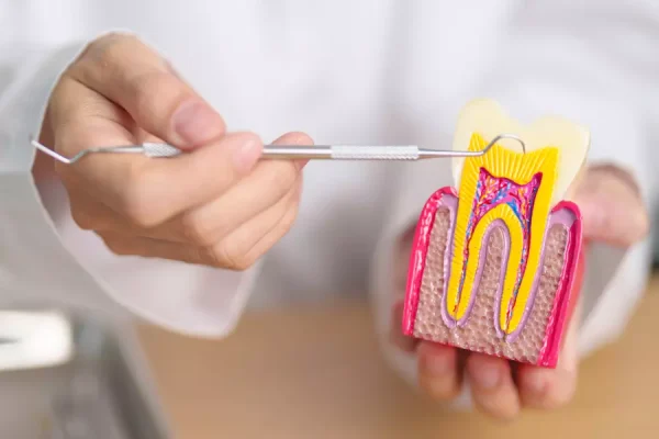 Root Canal Treatment