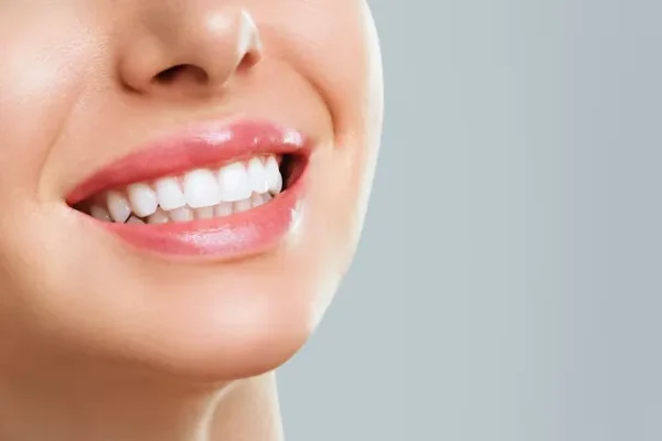 teeth-whitening-Treatment-in-Bavdhan2