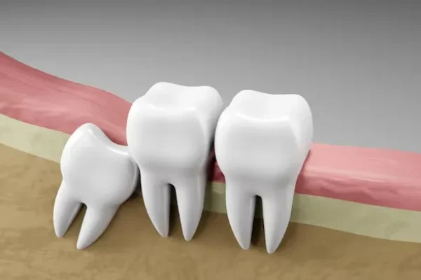 Maintenance & Preventive Gum Care